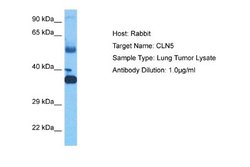 CLN5 Rabbit anti-Human, Polyclonal, Novus Biologicals 0.1 mL | Buy Online | Novus Biologicals | Fisher Scientific